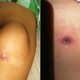 Illustration for article titled Tiny sea snail grows and hatches inside little boys knee